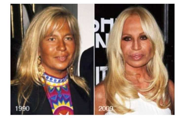 donatella prima e dopo