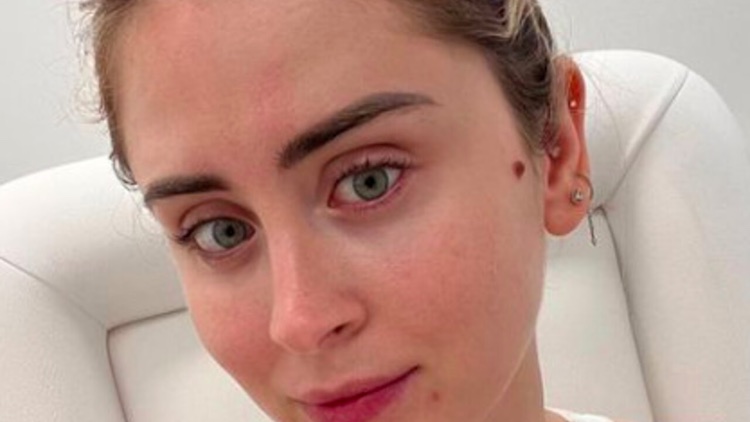 Valentina Ferragni altro dramma