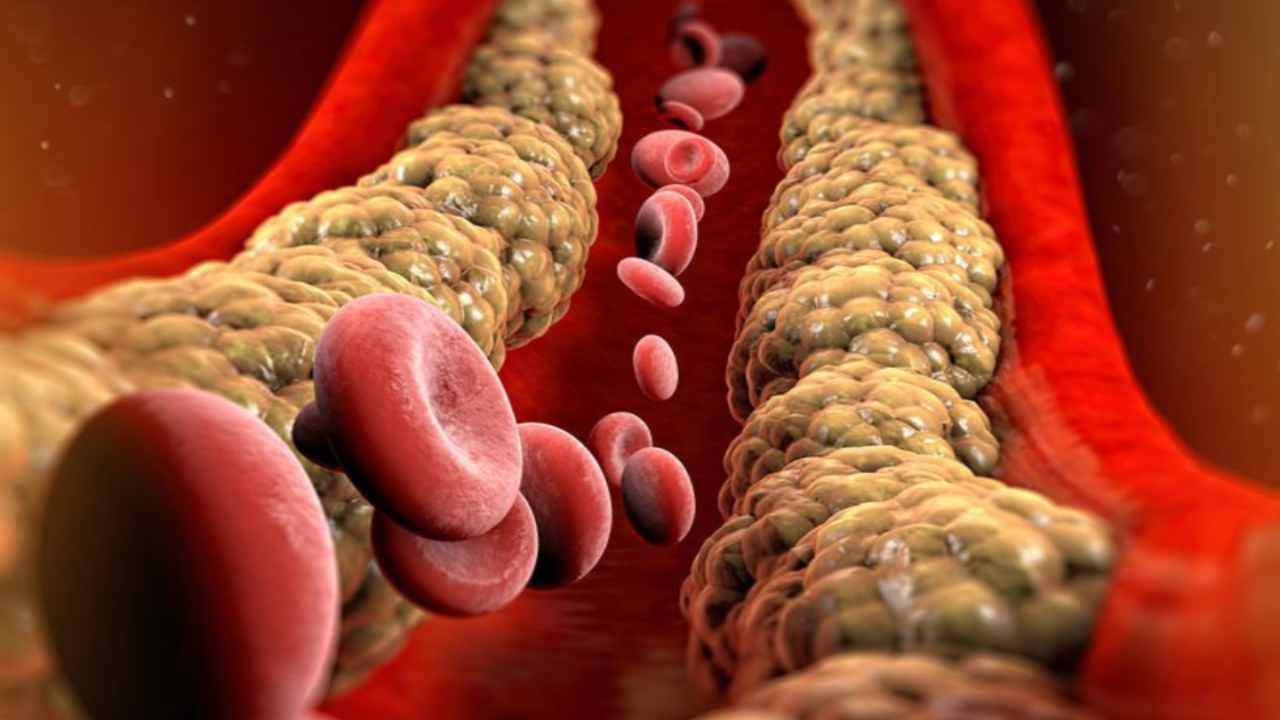 colesterolo nel sangue (Fonte Web)